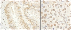 TFIIE-alpha Antibody, Novus Biologicals 0.1mL; Unlabeled:Antibodies, Polyclonal